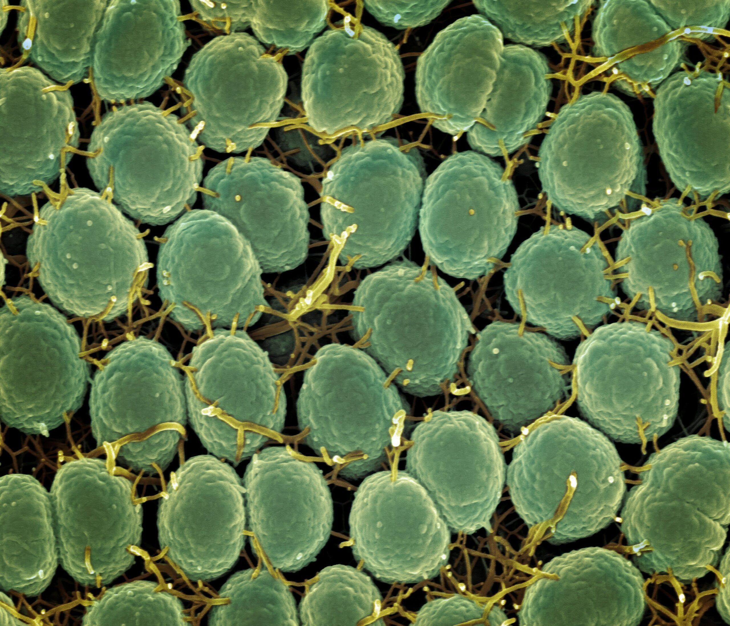 Illustration showing mold spores affecting respiratory system