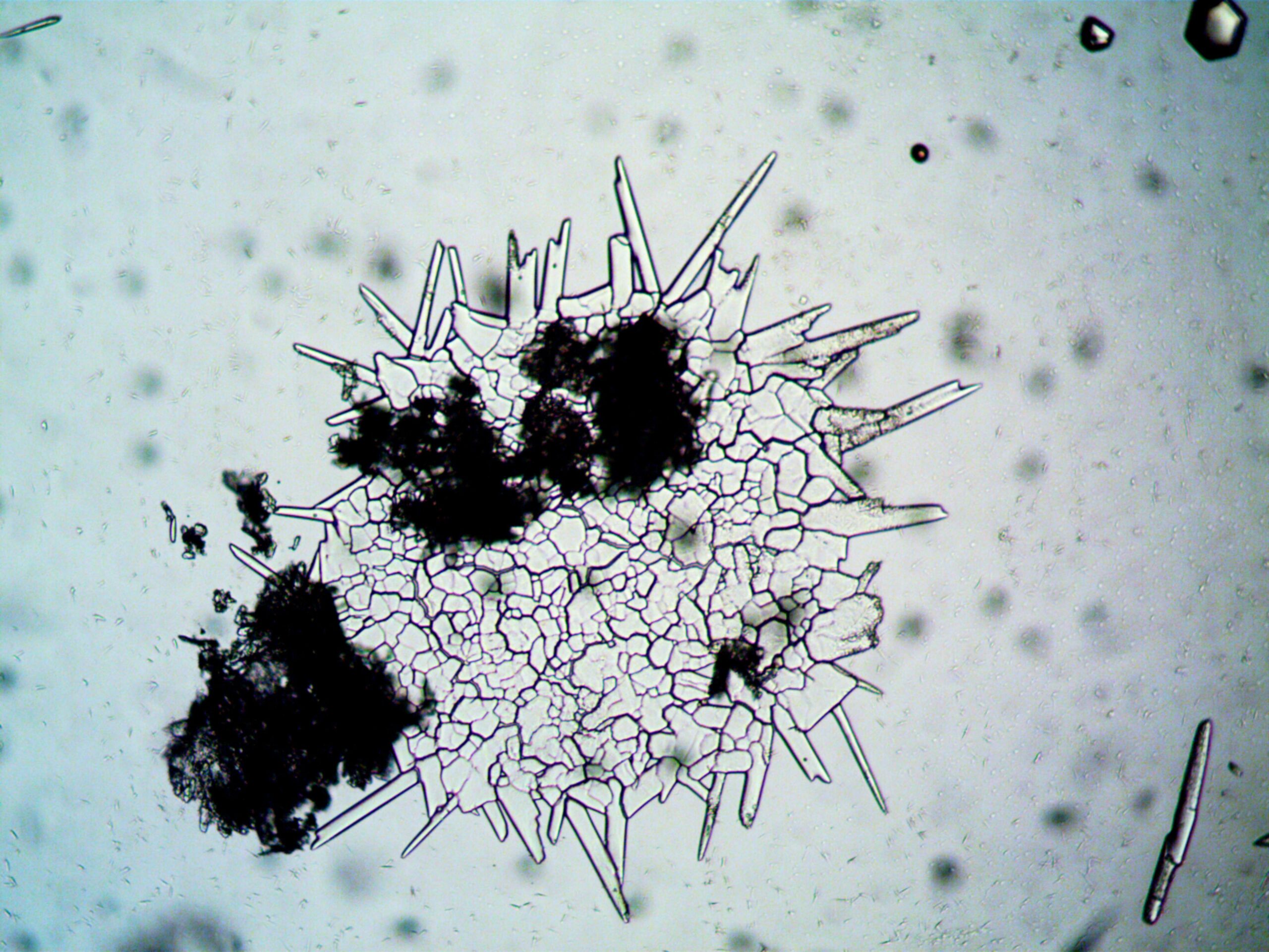 Mold spores magnified image showing potential allergens affecting humans